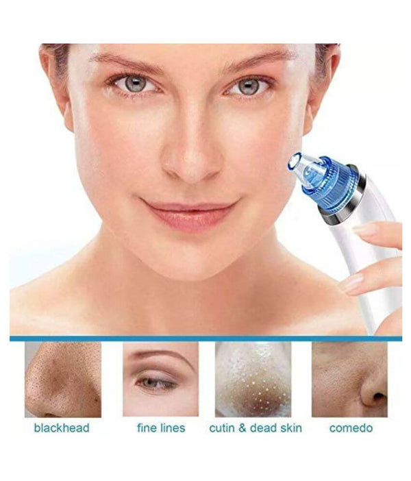 Апарат за чистење лице - Derma Suction